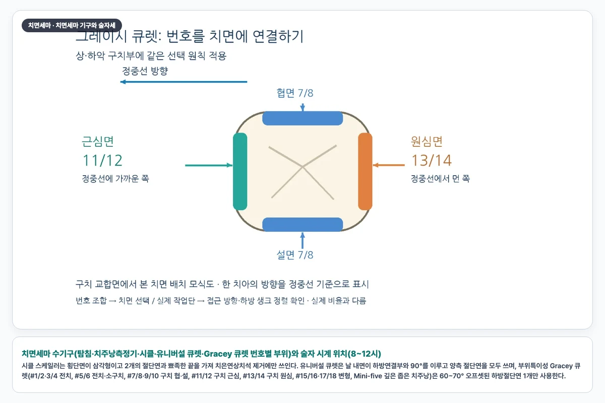 치면세마 수기구(탐침·치주낭측정기·시클·유니버설 큐렛·Gracey 큐렛 번호별 부위)와 술자 시계 위치(8~12시)