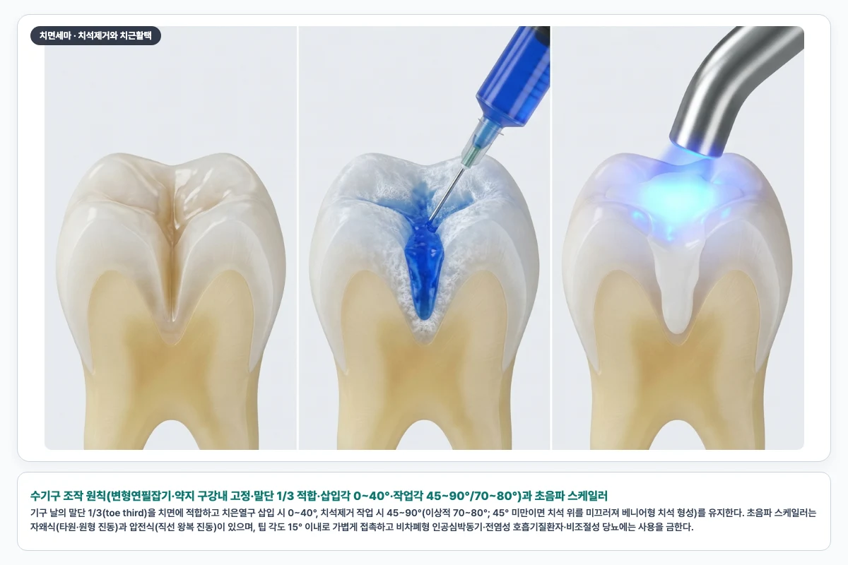 수기구 조작 원칙(변형연필잡기·약지 구강내 고정·말단 1/3 적합·삽입각 0~40°·작업각 45~90°/70~80°)과 초음파 스케일러