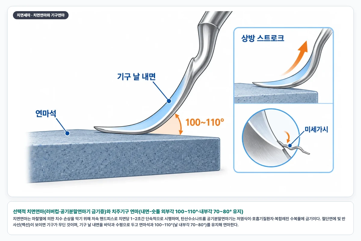 선택적 치면연마(러버컵·공기분말연마기 금기증)와 치주기구 연마(내면-숫돌 외부각 100~110°·내부각 70~80° 유지)