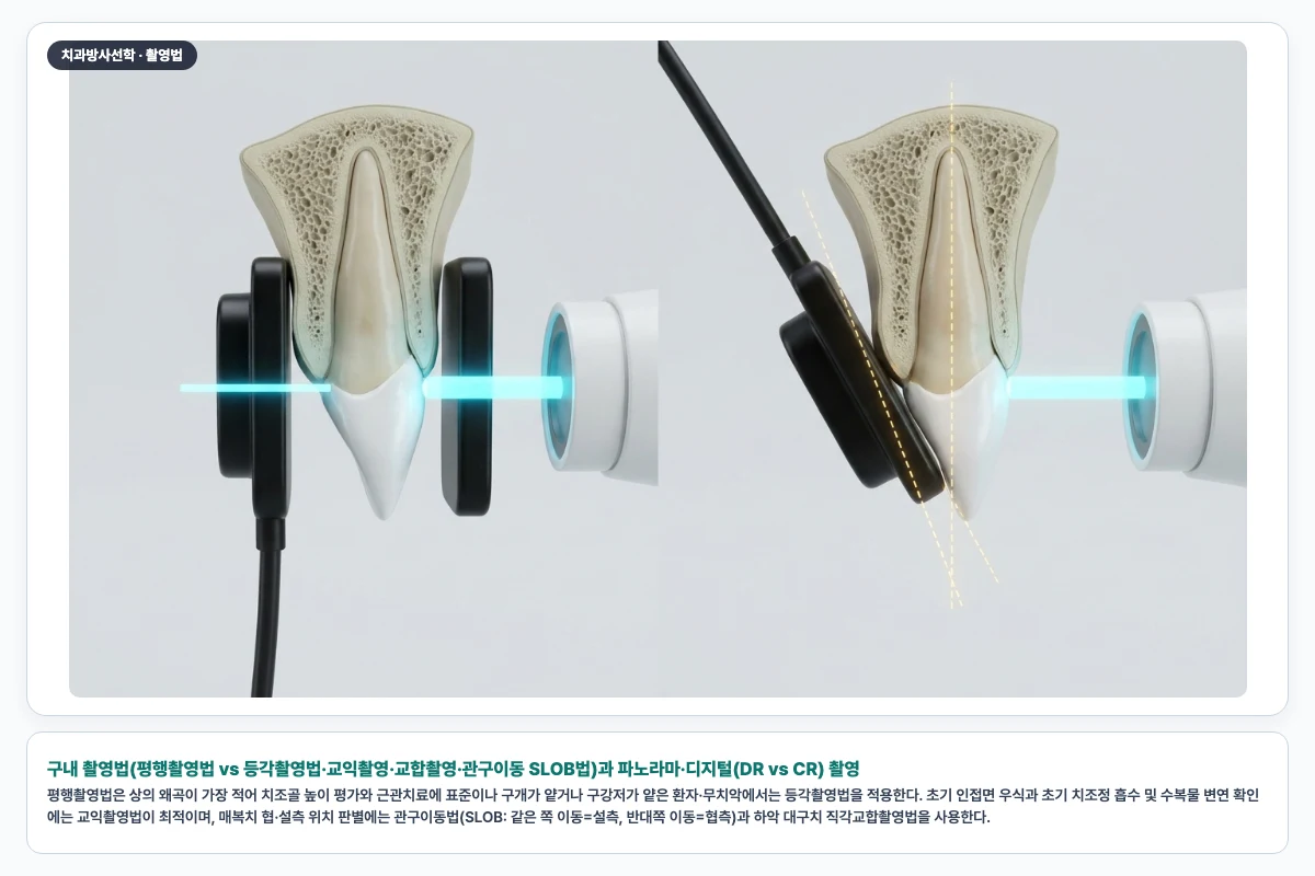 구내 촬영법(평행촬영법 vs 등각촬영법·교익촬영·교합촬영·관구이동 SLOB법)과 파노라마·디지털(DR vs CR) 촬영
