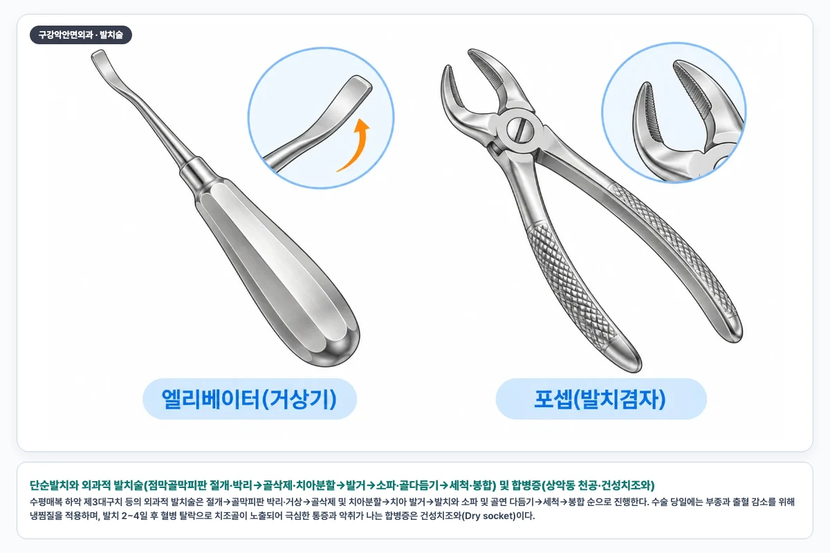 단순발치와 외과적 발치술(점막골막피판 절개·박리→골삭제·치아분할→발거→소파·골다듬기→세척·봉합) 및 합병증(상악동 천공·건성치조와)