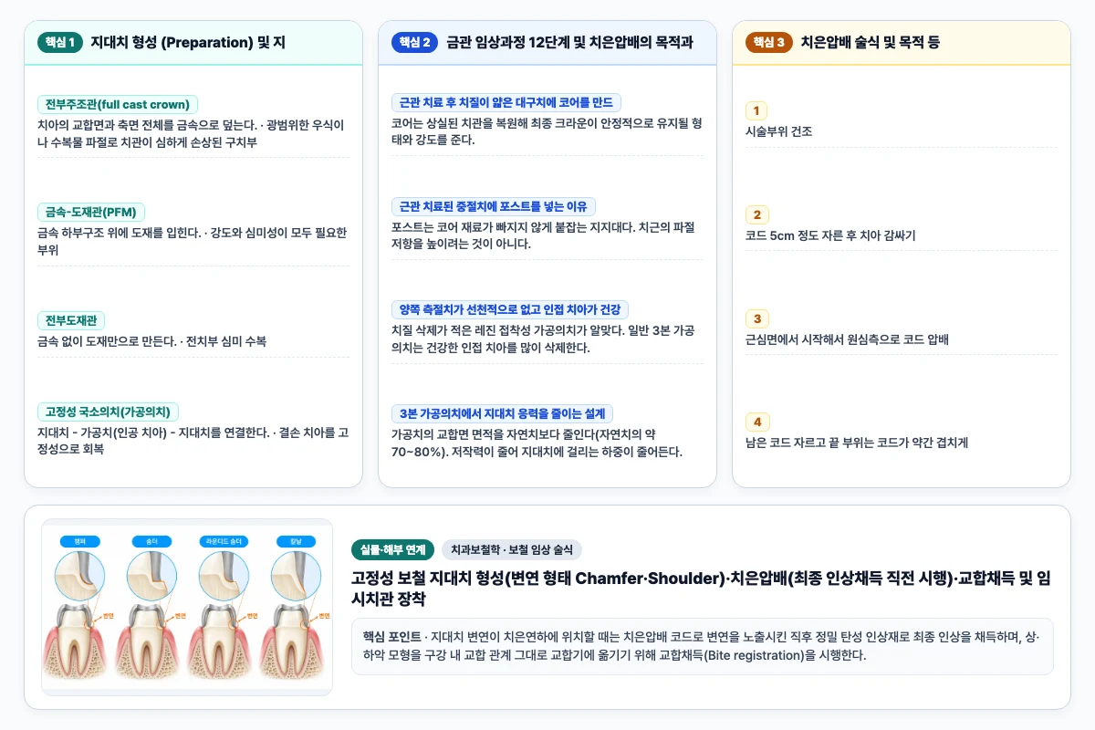 치과보철학 보철 임상 술식 핵심 비교 및 단계별 기전 도해