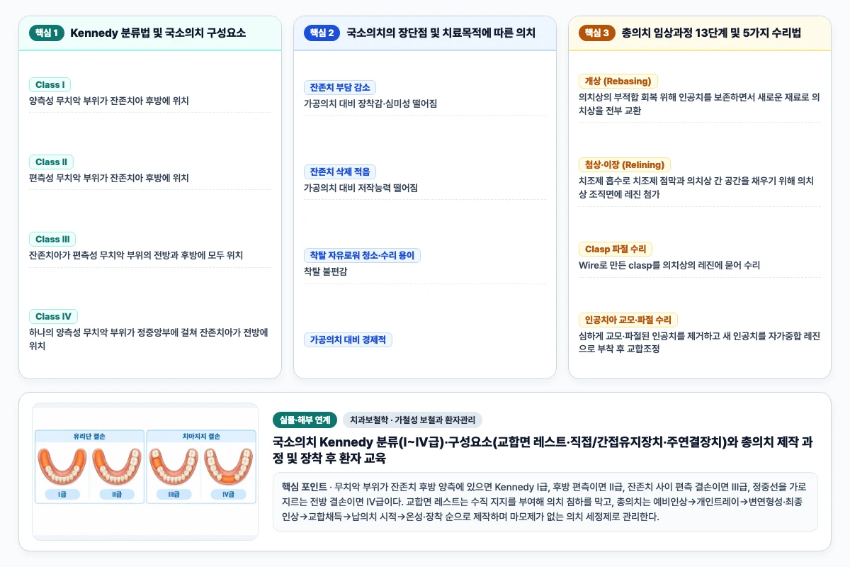치과보철학 가철성 보철과 환자관리 핵심 비교 및 단계별 기전 도해