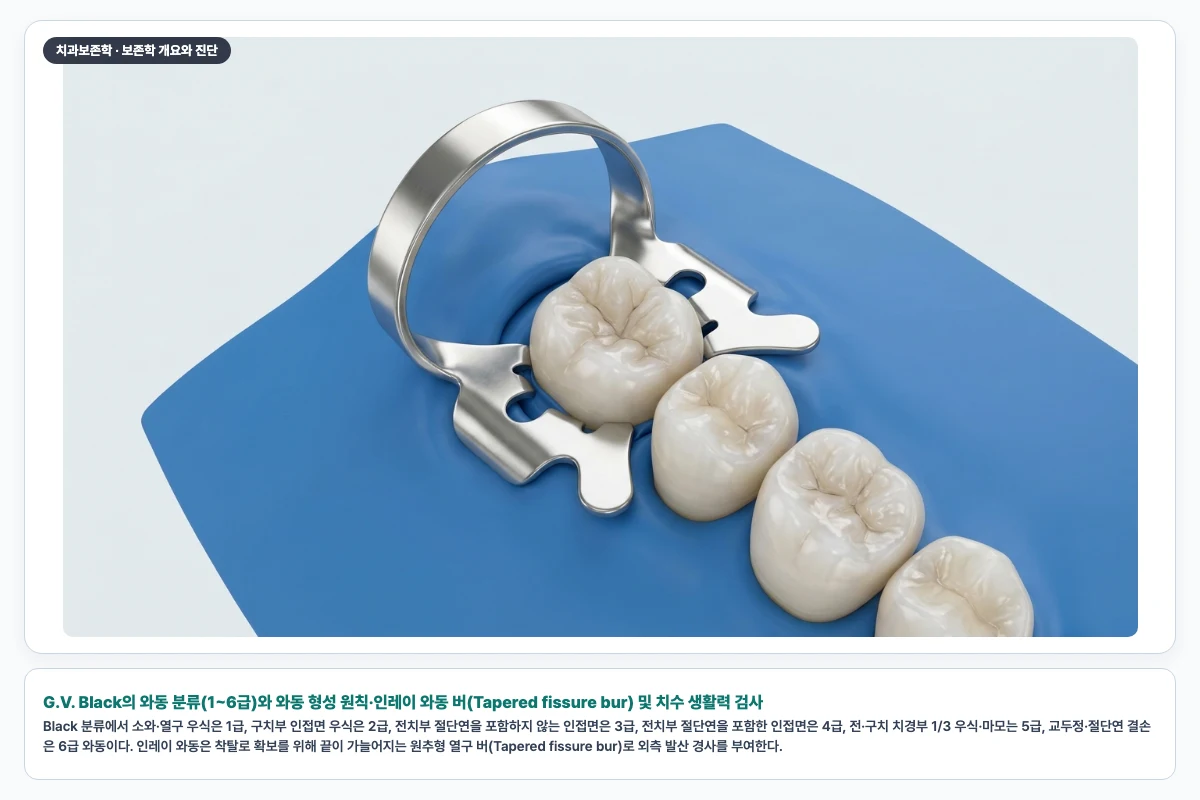 G.V. Black의 와동 분류(1~6급)와 와동 형성 원칙·인레이 와동 버(Tapered fissure bur) 및 치수 생활력 검사
