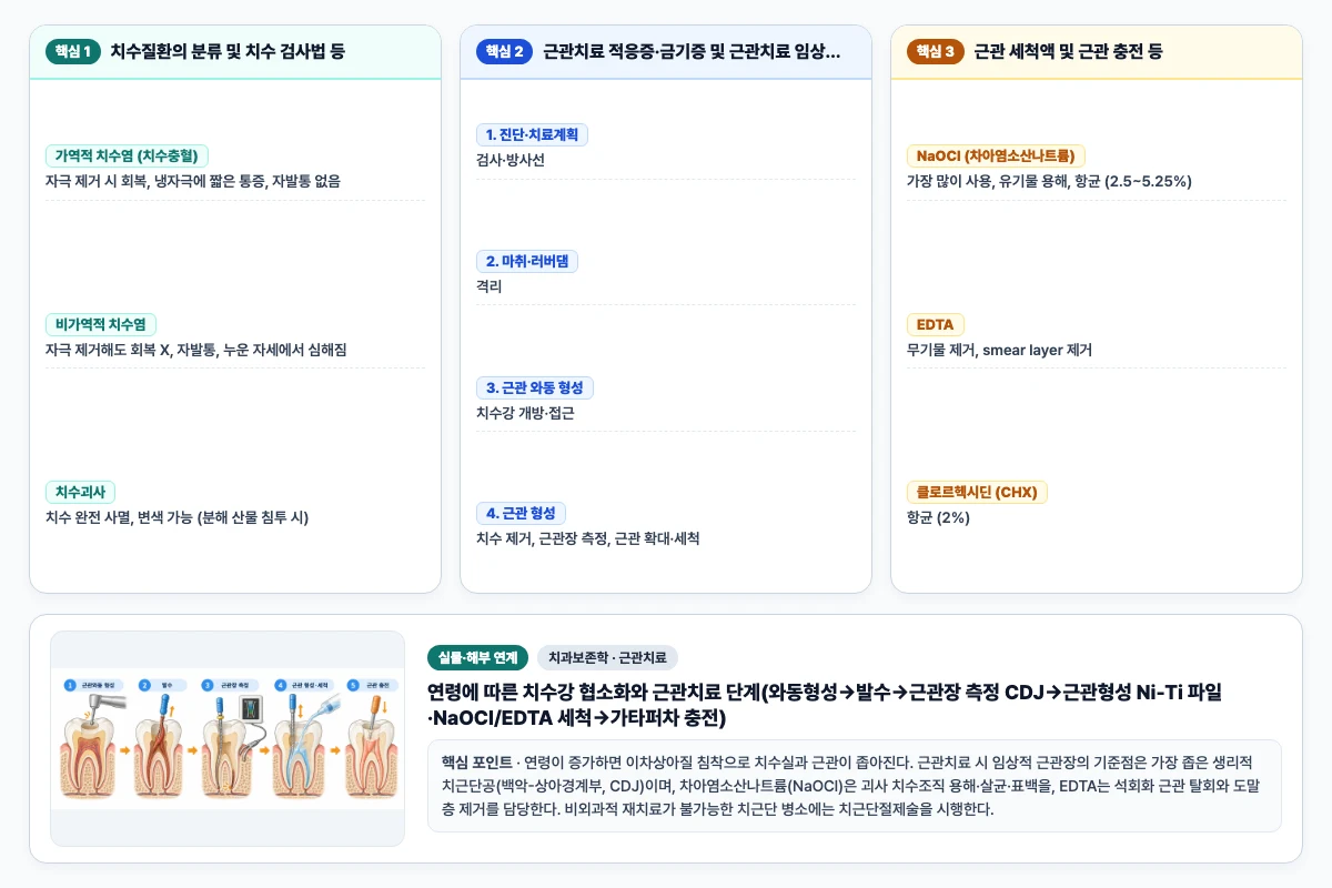 치과보존학 근관치료 핵심 비교 및 단계별 기전 도해