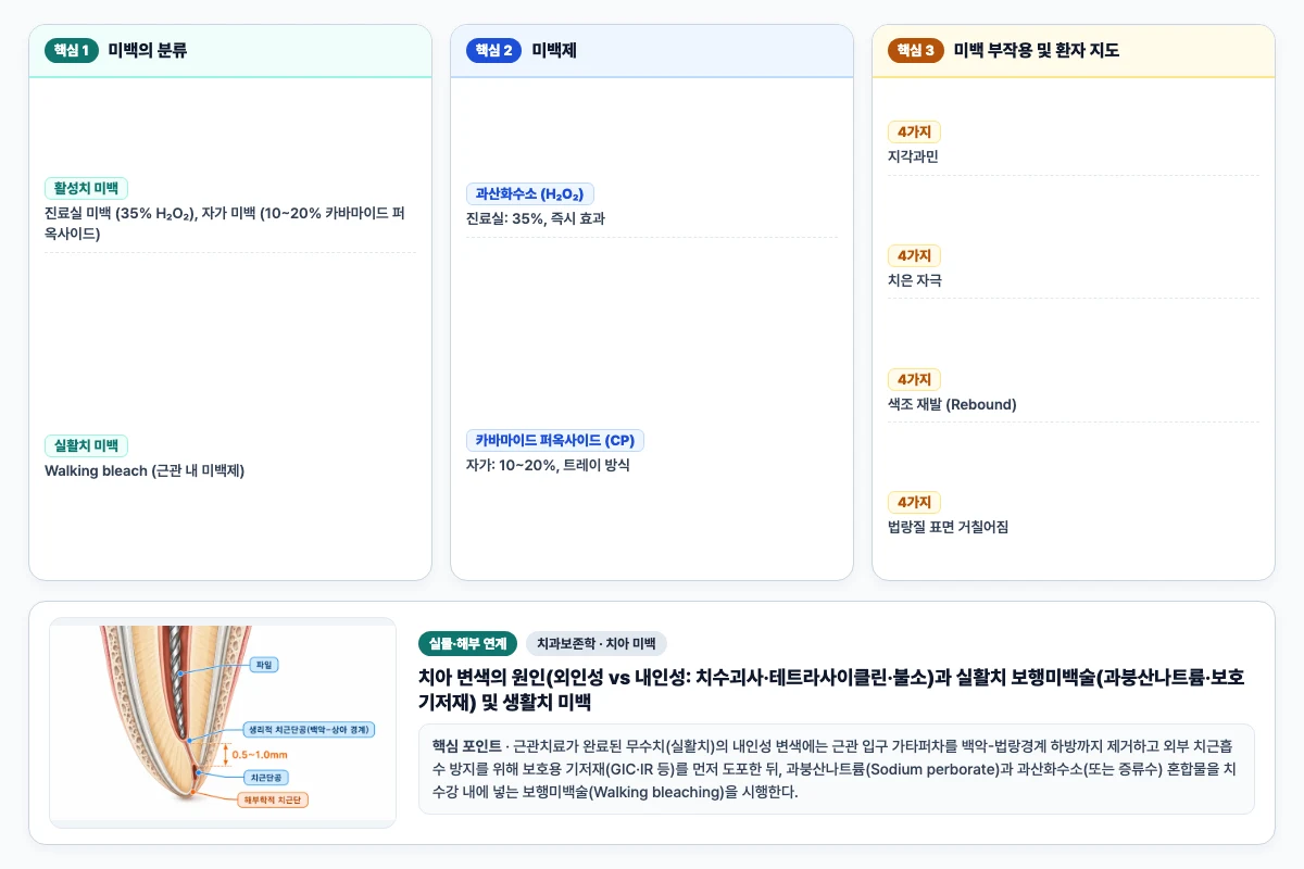 치과보존학 치아 미백 핵심 비교 및 단계별 기전 도해