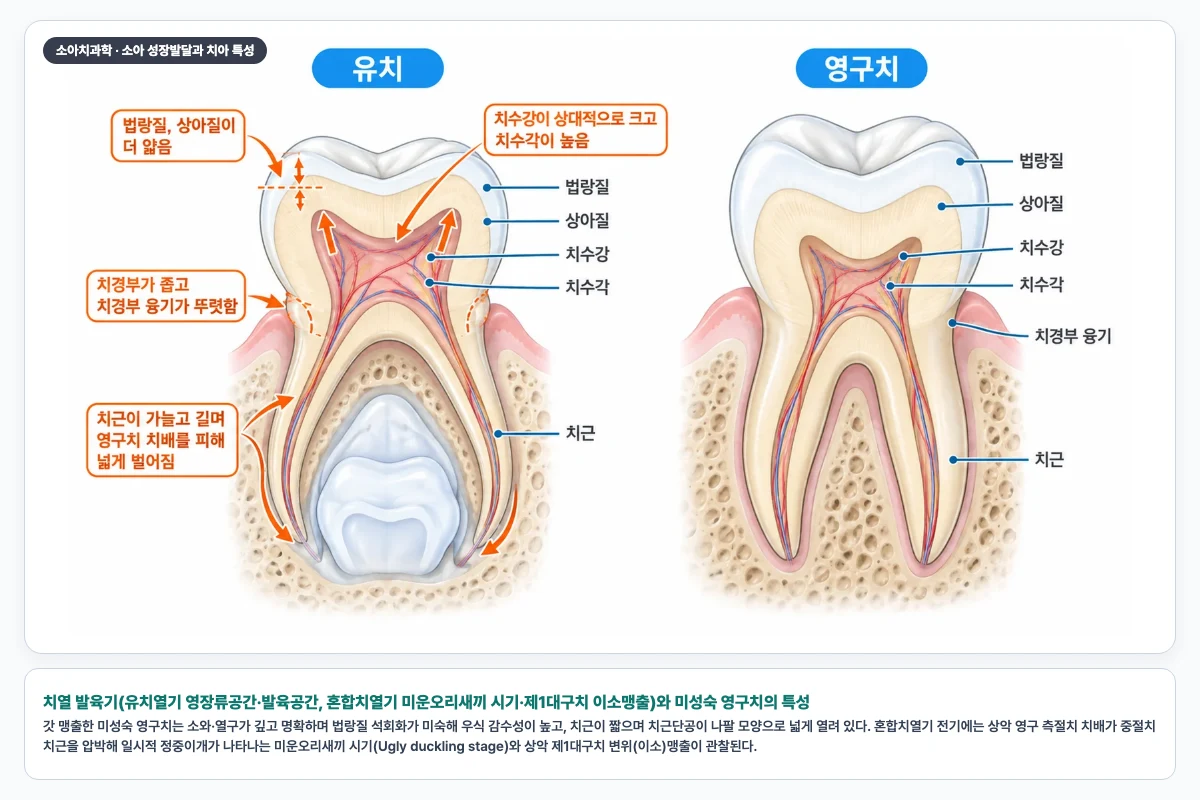 치열 발육기(유치열기 영장류공간·발육공간, 혼합치열기 미운오리새끼 시기·제1대구치 이소맹출)와 미성숙 영구치의 특성