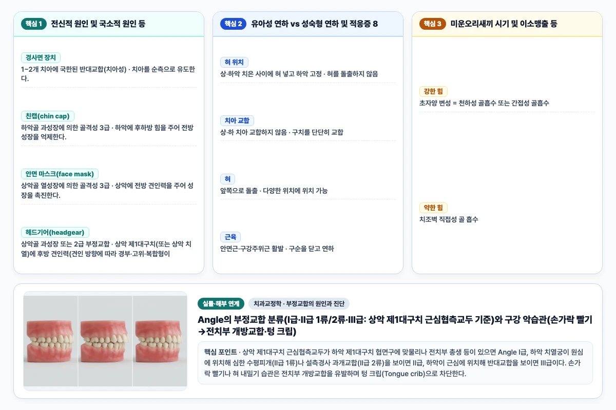 치과교정학 부정교합의 원인과 진단 핵심 비교 및 단계별 기전 도해