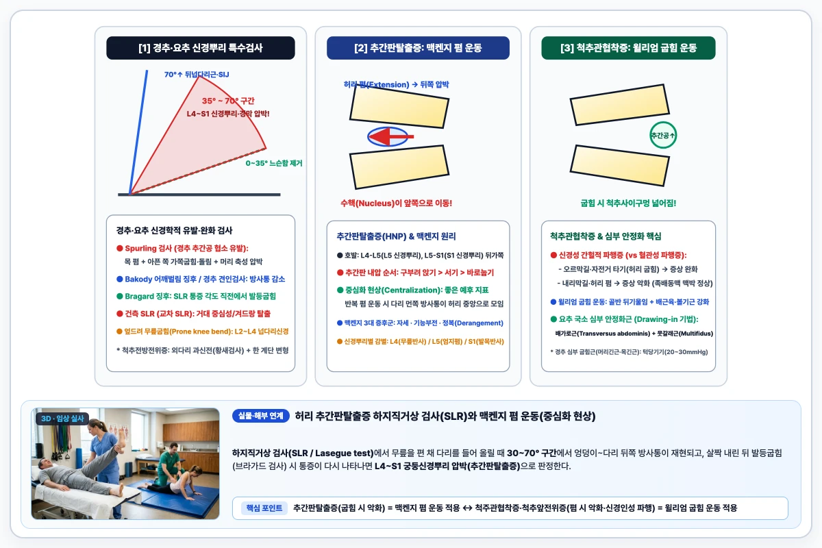 목·허리척추 신경뿌리 압박 검사(Spurling, SLR 각도별 긴장 구조물)와 맥켄지 폄 운동 대 윌리엄 굽힘 운동 비교 도해