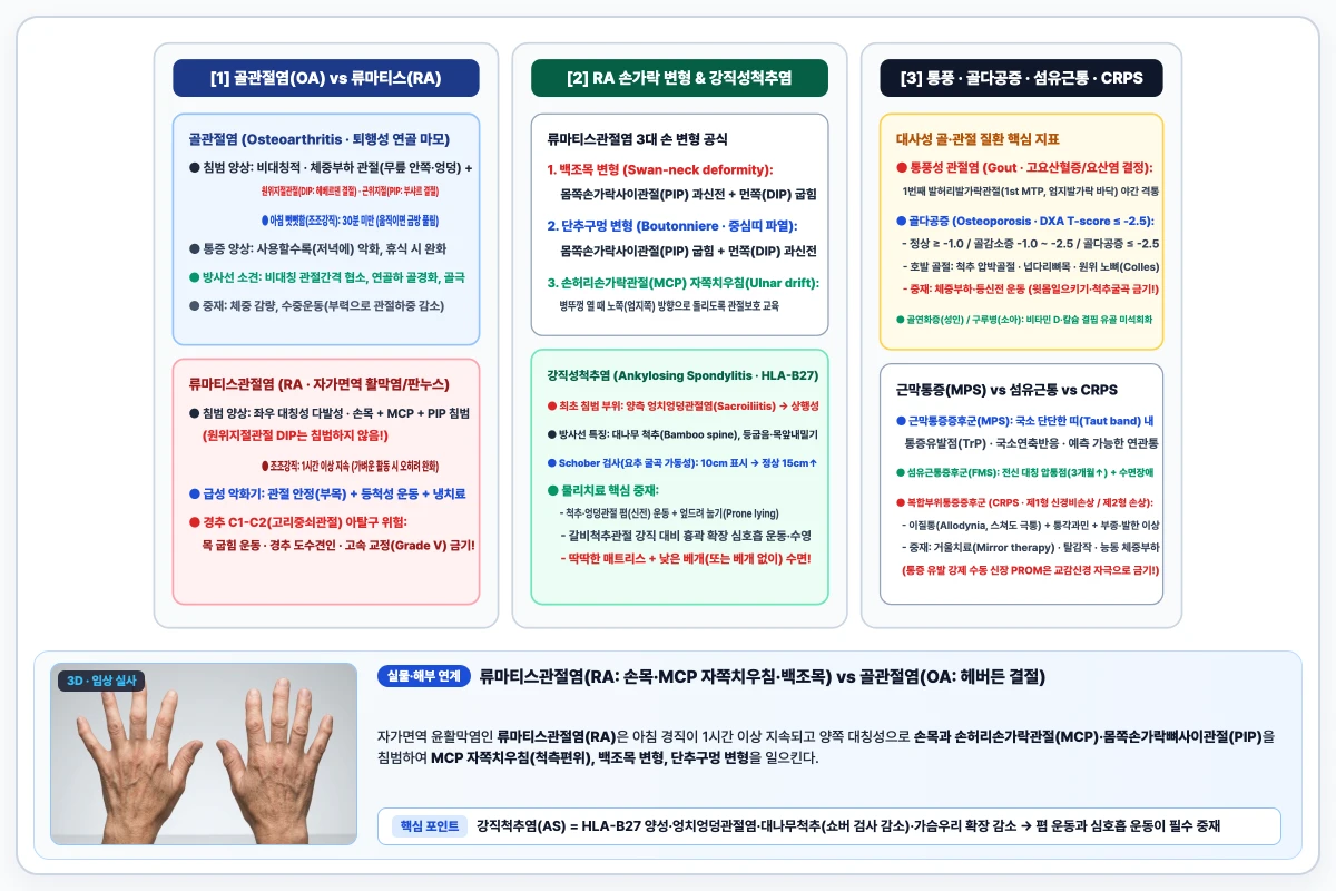 골관절염(OA 비대칭, 헤베르덴 결절) 대 류마티스관절염(RA 대칭, 백조목 및 단추구멍 변형)과 복합부위통증증후군(CRPS) 비교 도해