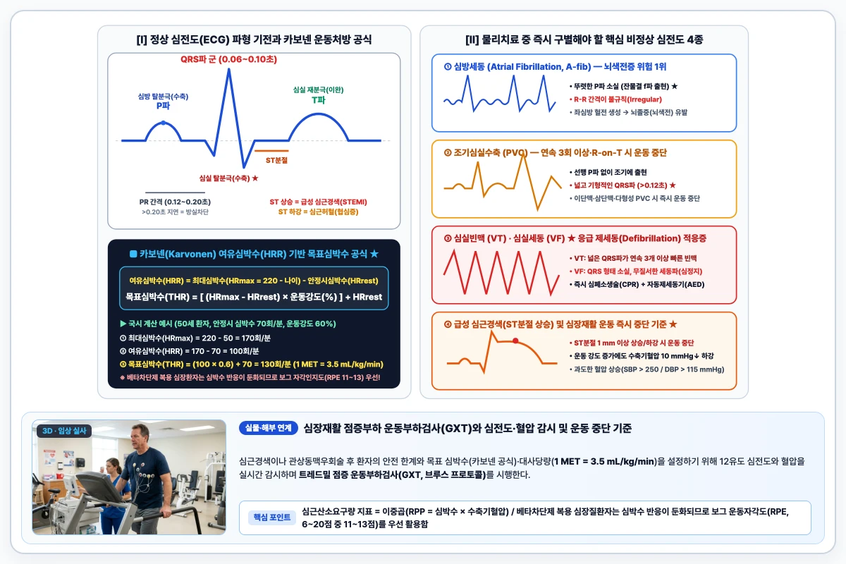 심전도(ECG) 정상 P-QRS-T 파형과 응급 부정맥 4종 판독 및 카보넨 목표심박수 공식 도해