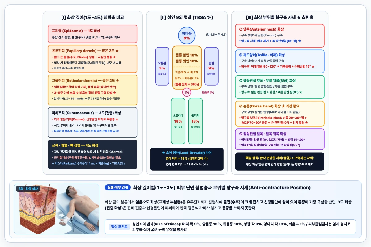 화상 깊이 1도~4도 침범 피부층, 성인 9의 법칙(Rule of Nines) 체표면적 및 부위별 항구축 자세 도해