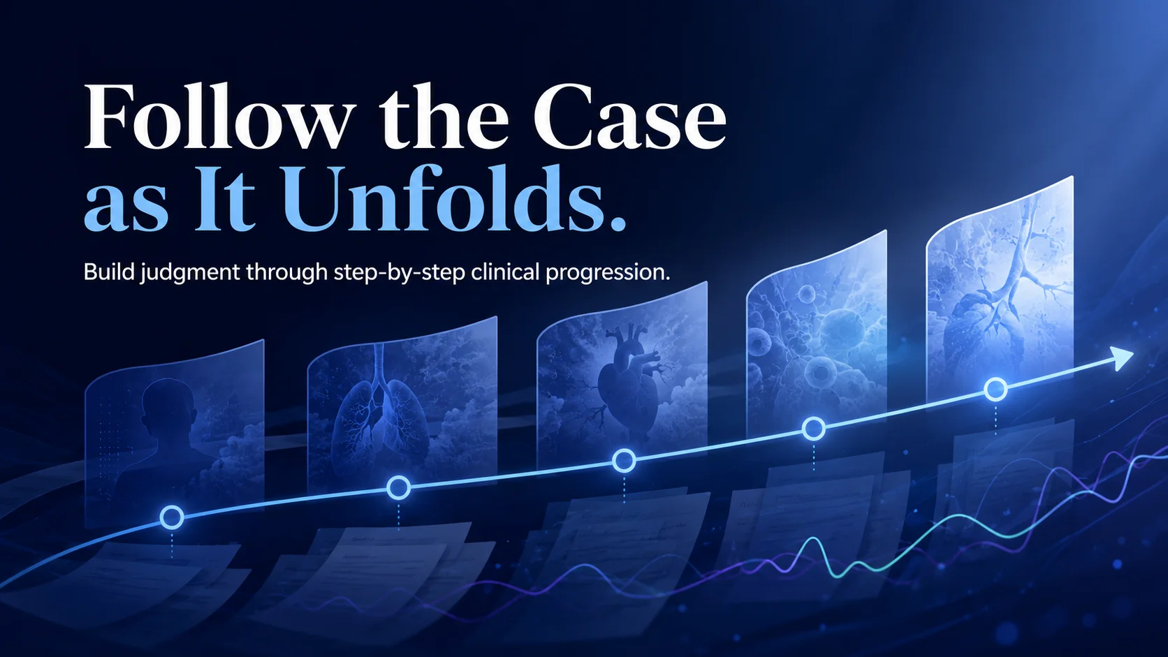 Unfolding Case Study Trainer