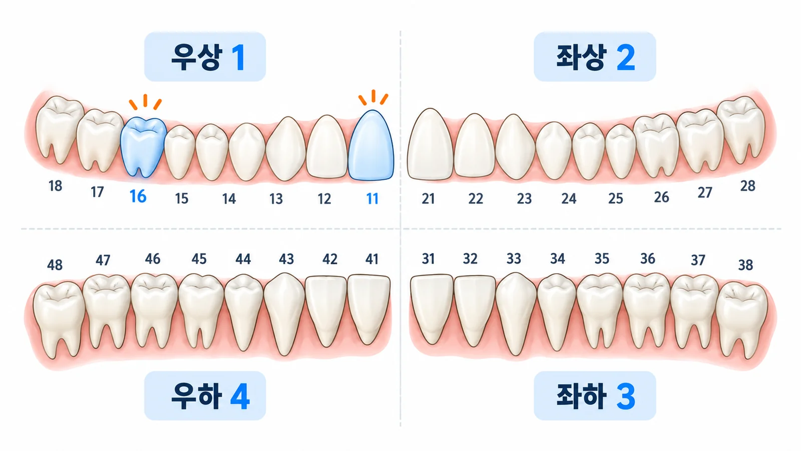 FDI 치아표기법