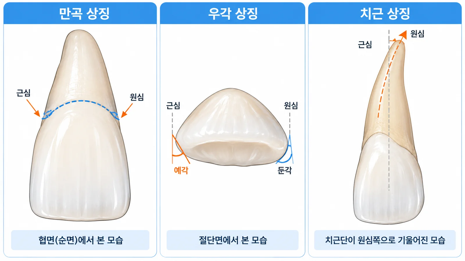 치아의 3대 상징