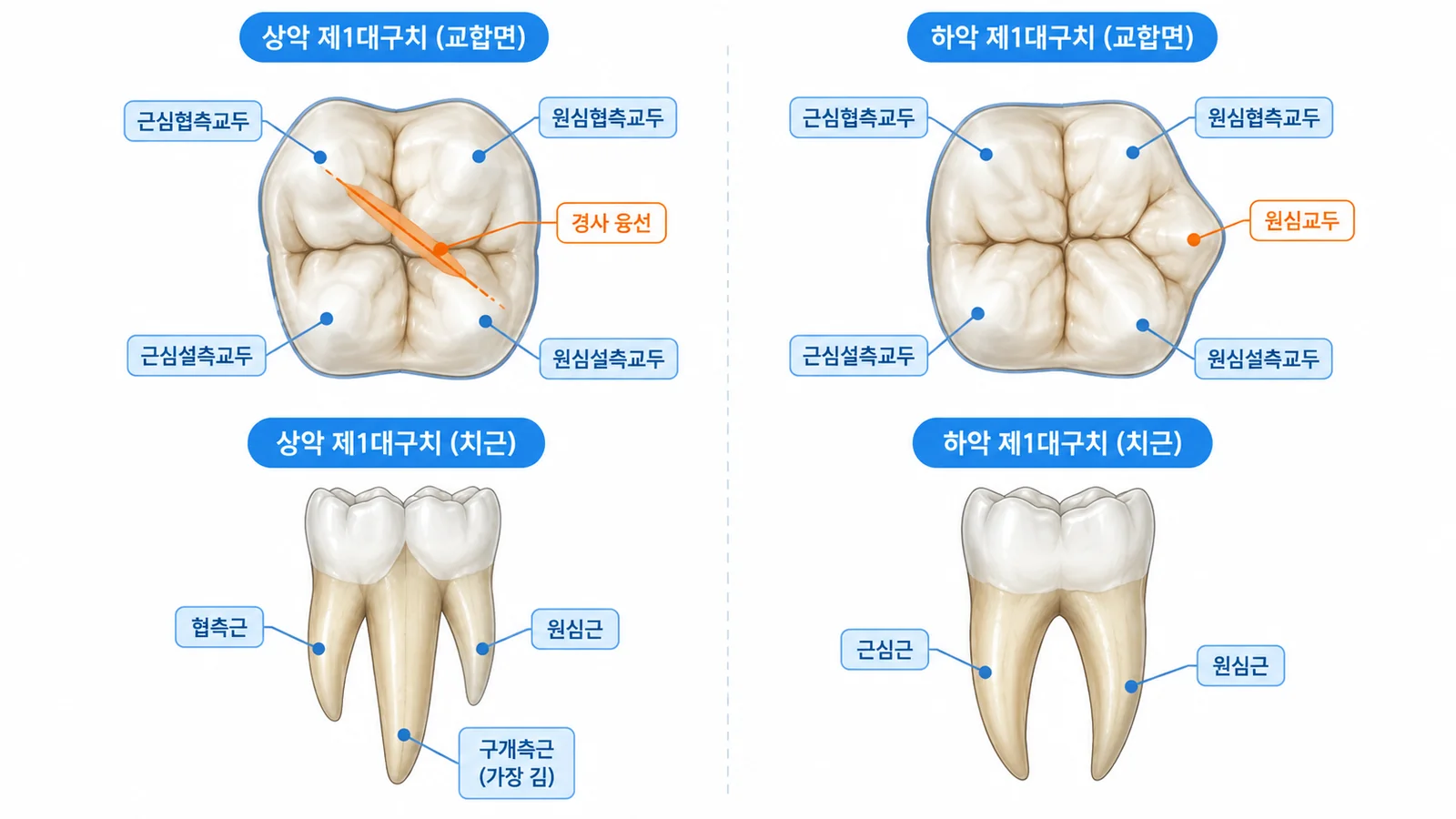 상악·하악 제1대구치 교합면 비교