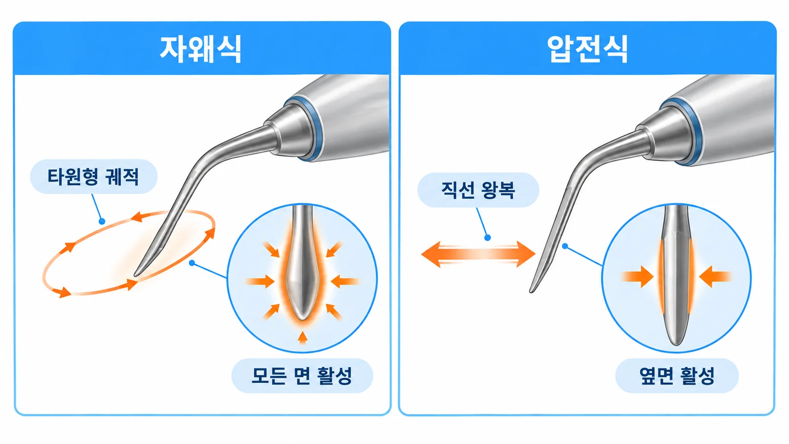 초음파 팁의 움직임: 자왜식 vs 압전식
