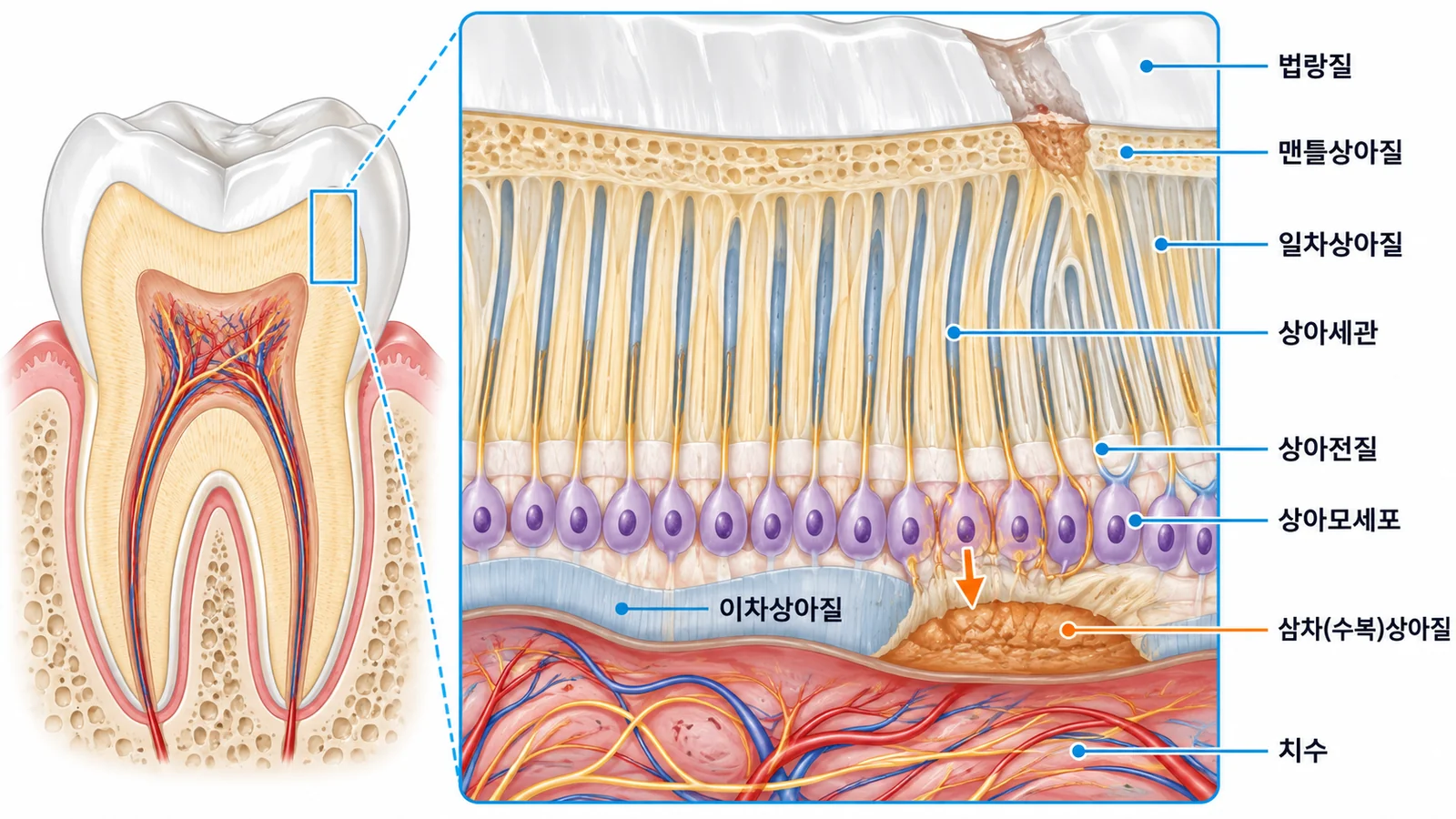 상아질의 구조