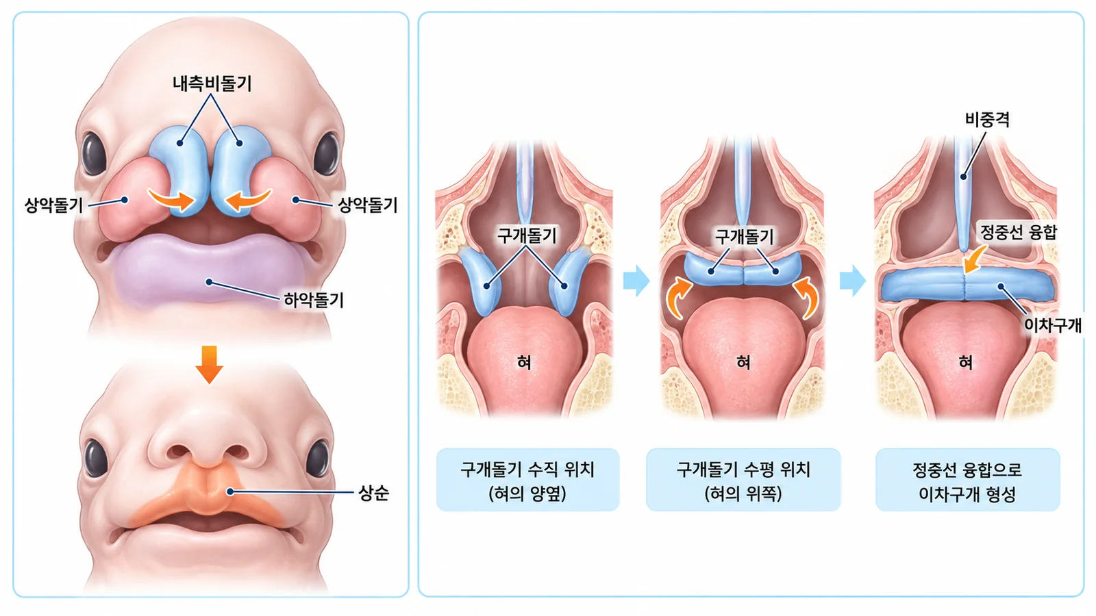 얼굴 돌기와 구개의 융합