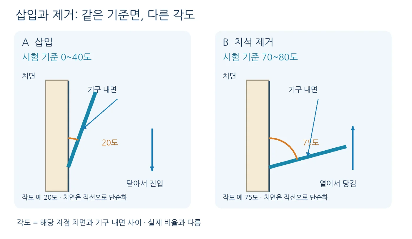 삽입 각도와 치석 제거 작업 각도
