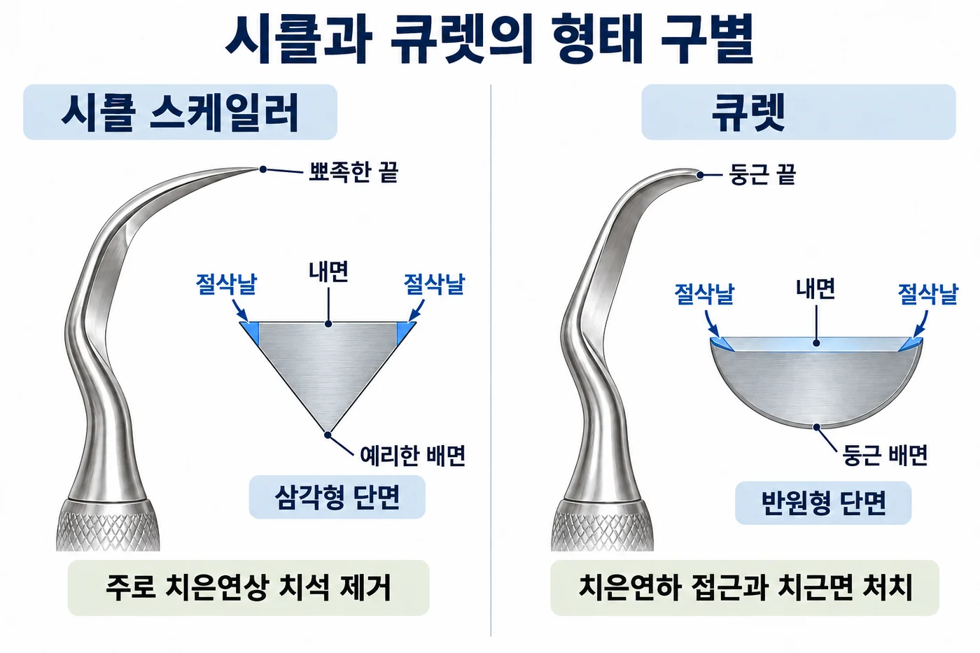 시클과 큐렛의 형태 구별