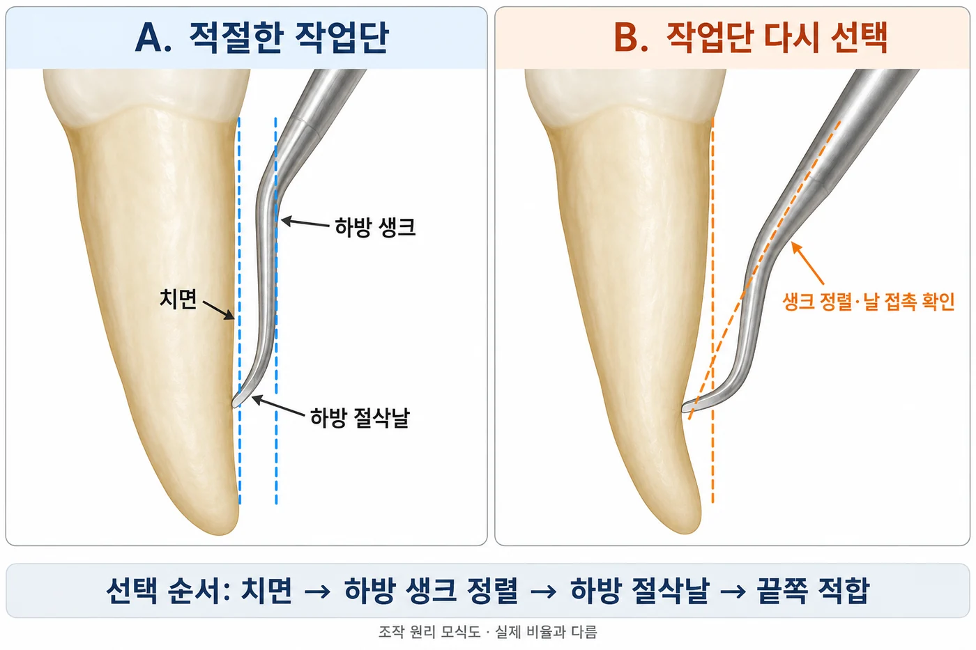 하방 생크 정렬과 작업단 선택