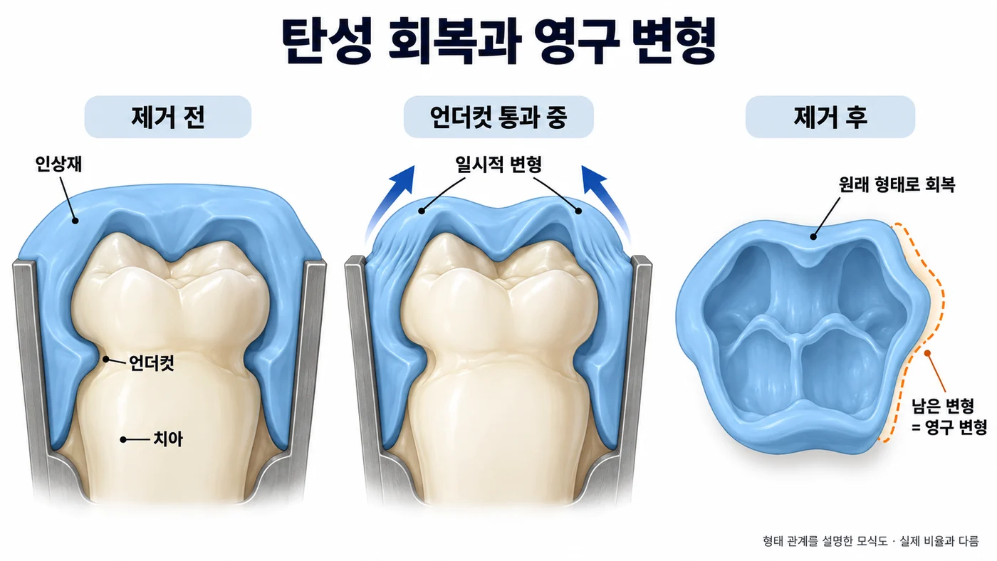 탄성 회복과 영구 변형