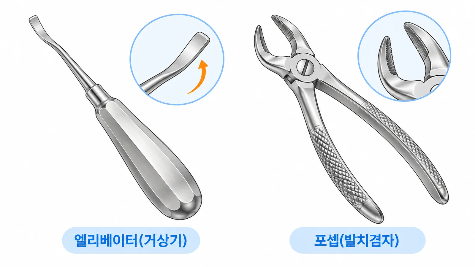 발치 기구