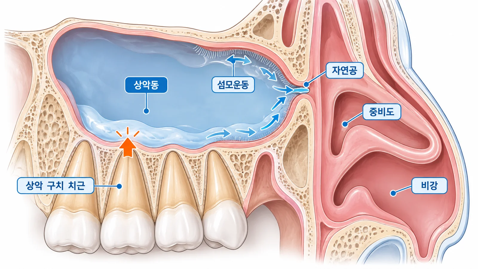 상악동 천공과 자연공