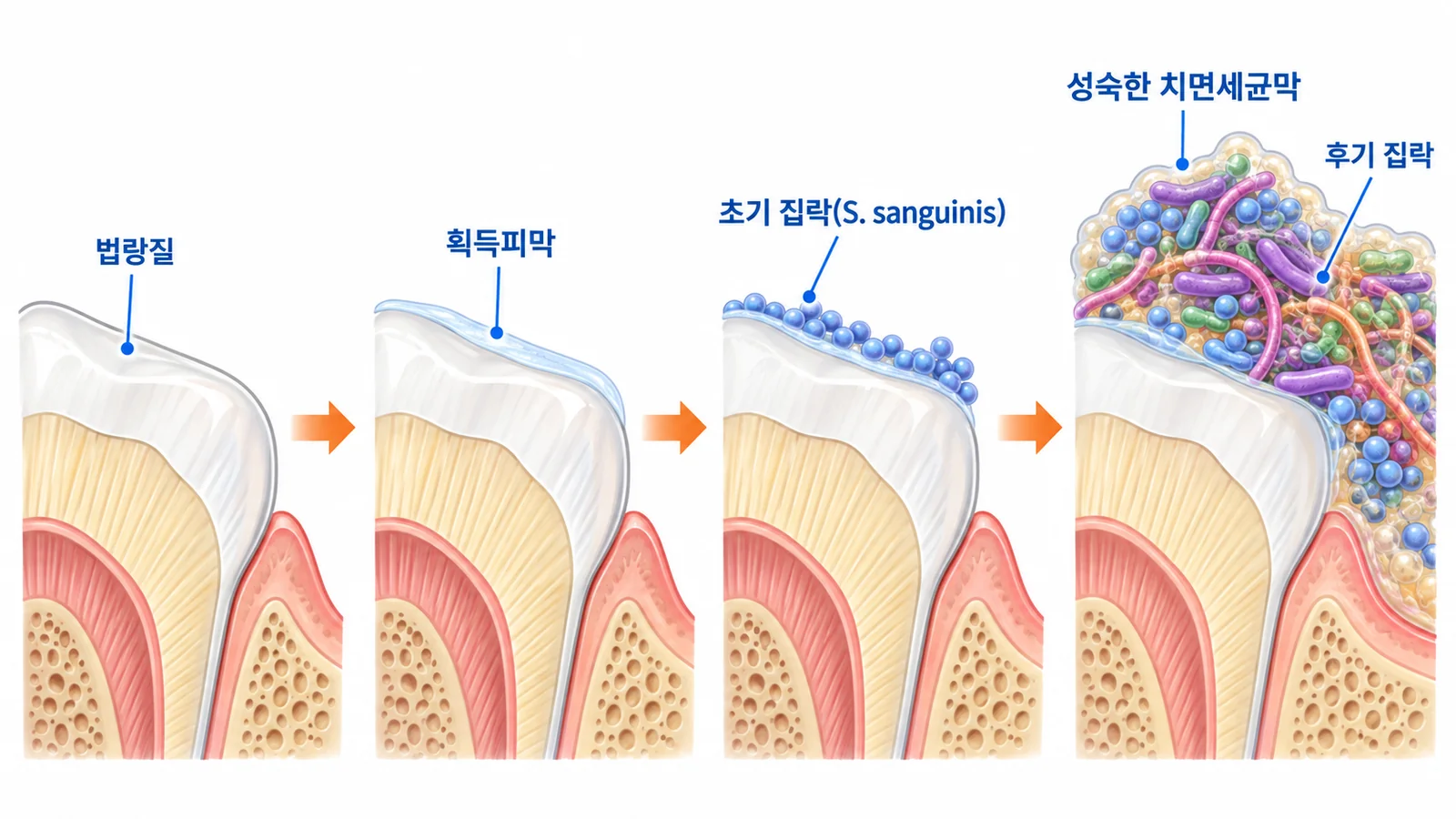치면세균막의 형성 과정