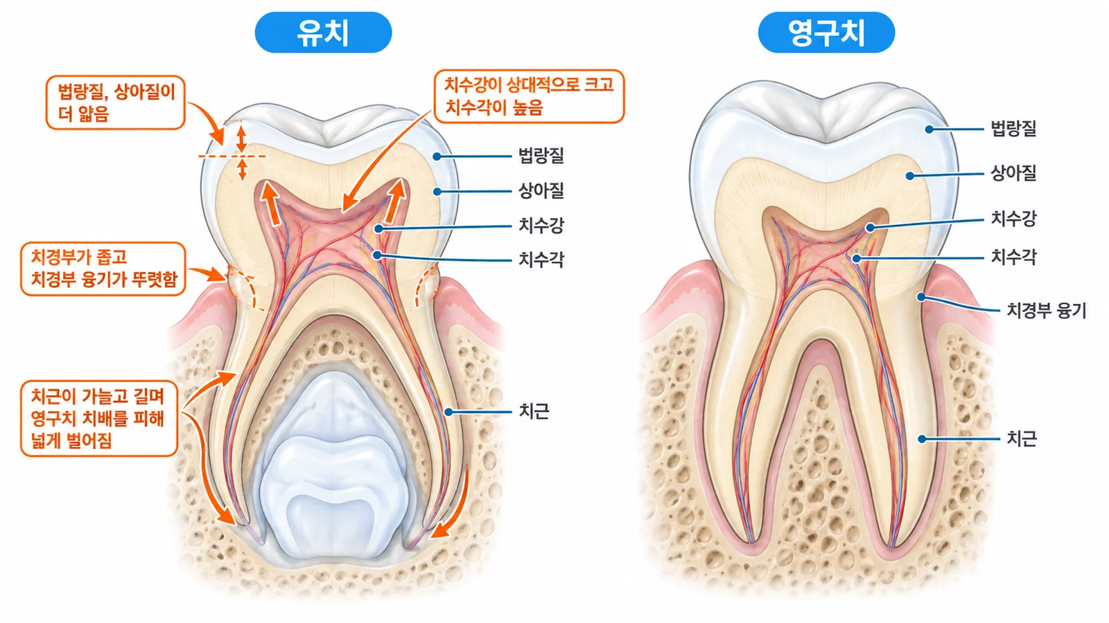유치와 영구치 비교