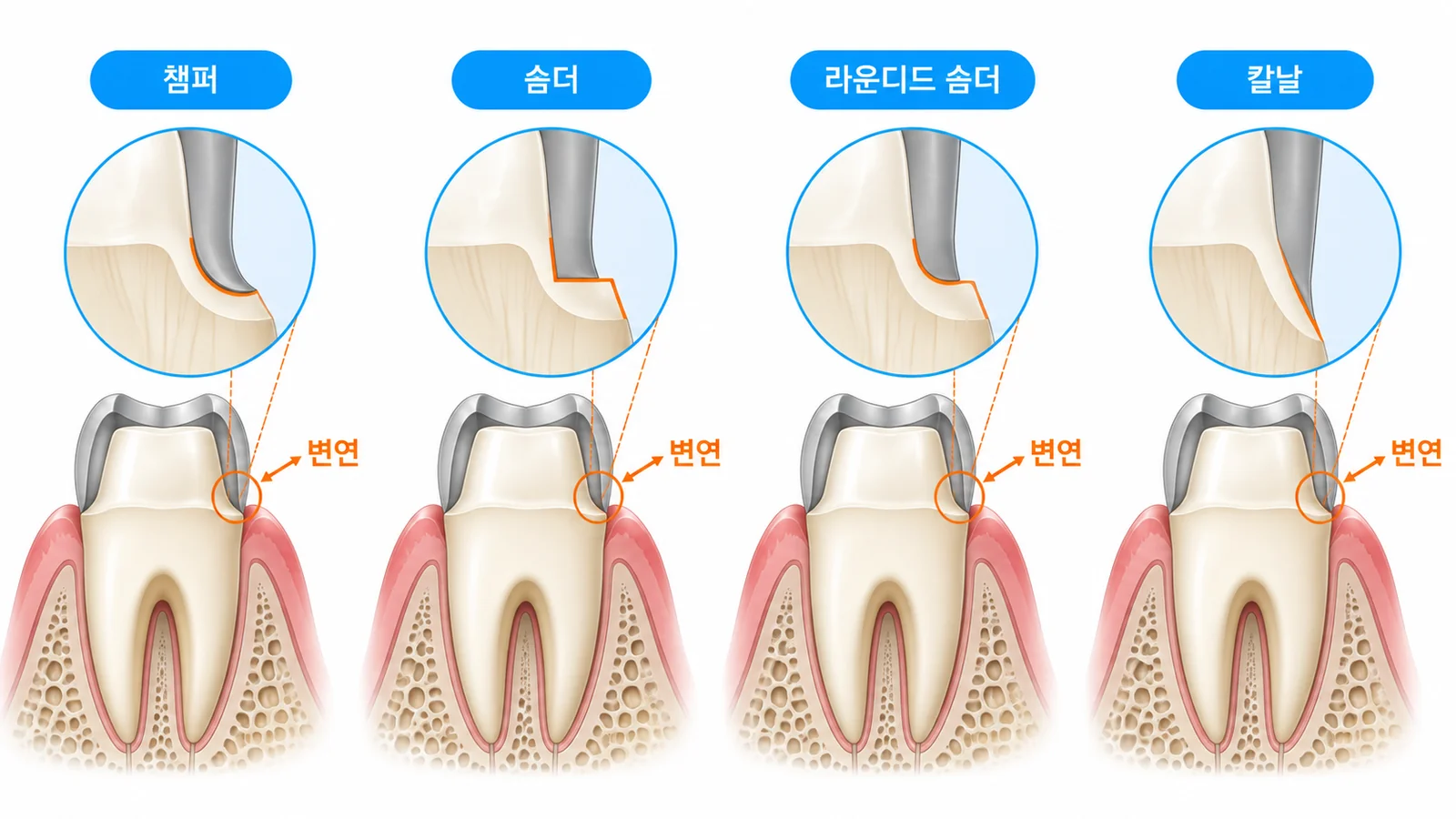 지대치 변연 형태