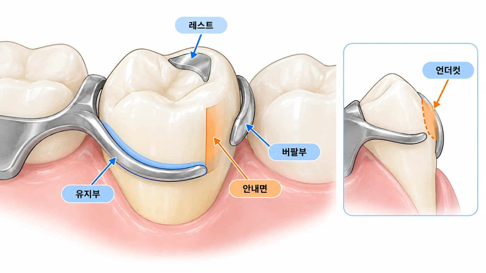 클래스프와 지대치