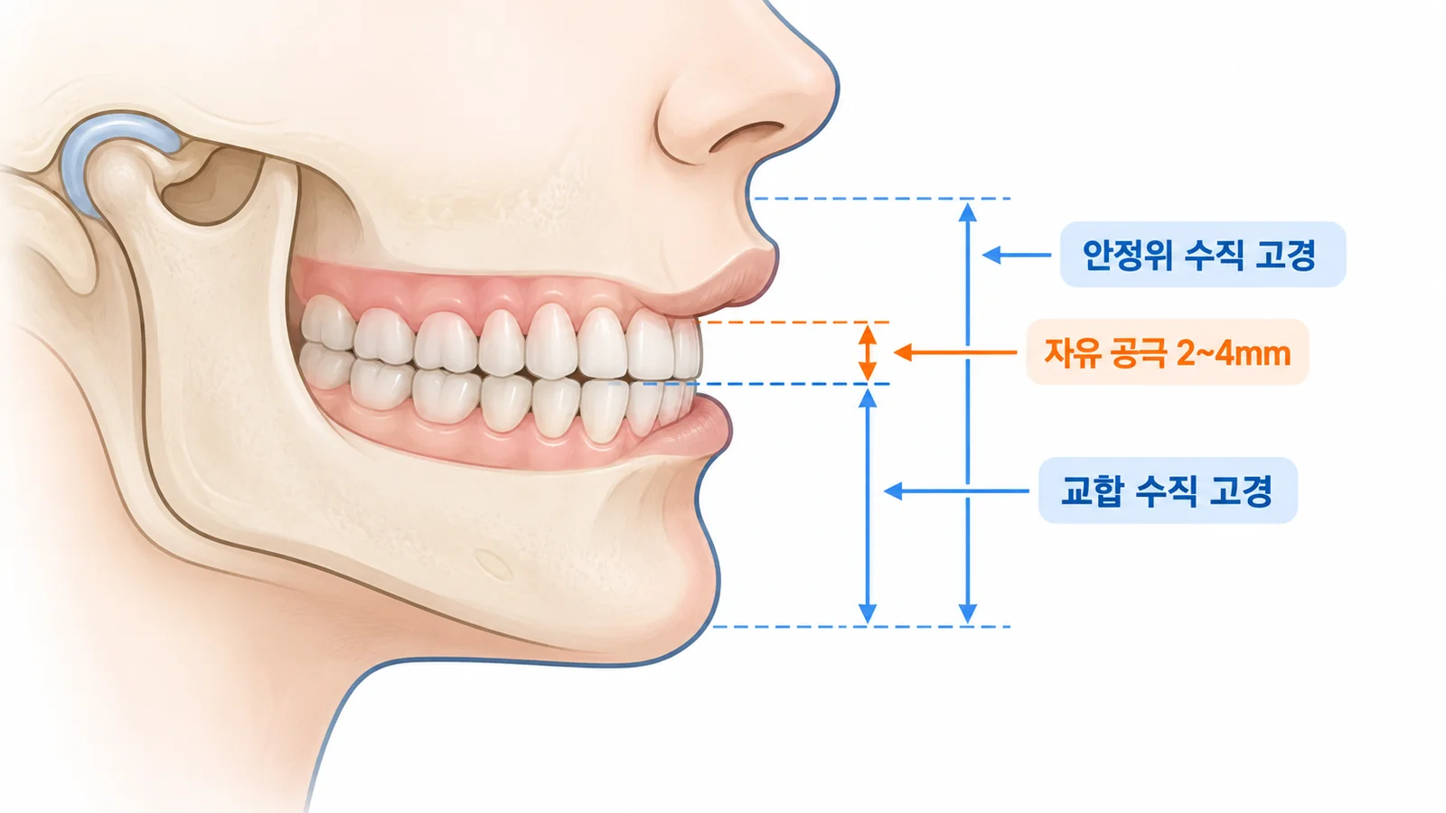 수직 고경