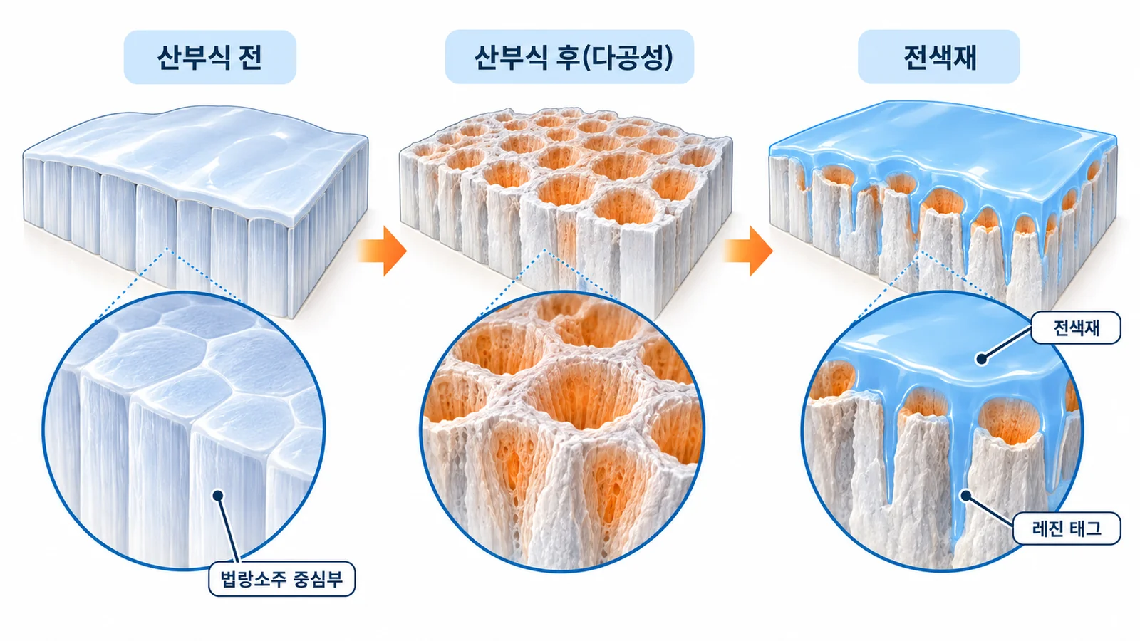 산부식 전후의 법랑질 표면