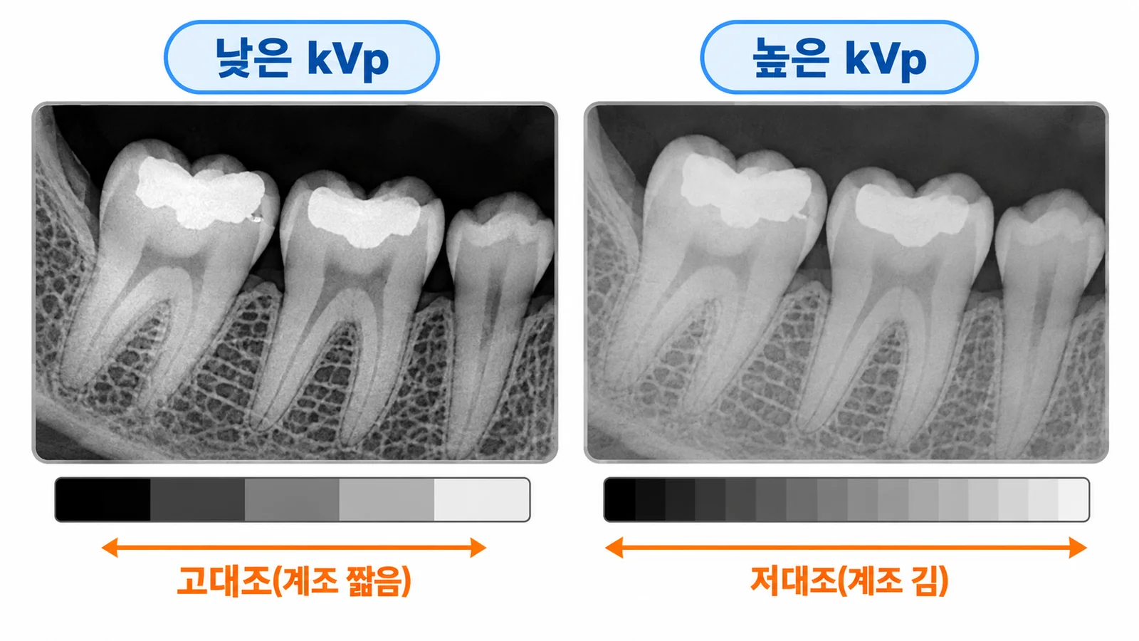 관전압에 따른 대조도 비교