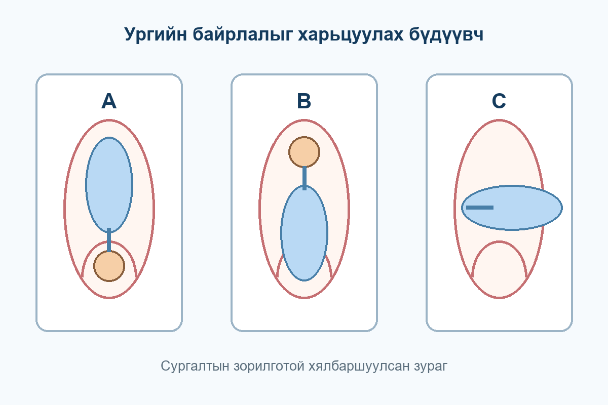 A ургийн толгой доош, B толгой дээш, C ураг хөндлөн байрласан гурван бүдүүвч
